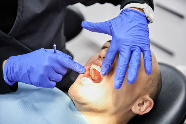 Best Emergency Dentist for Lost Fillings or Crowns in Independence, LA